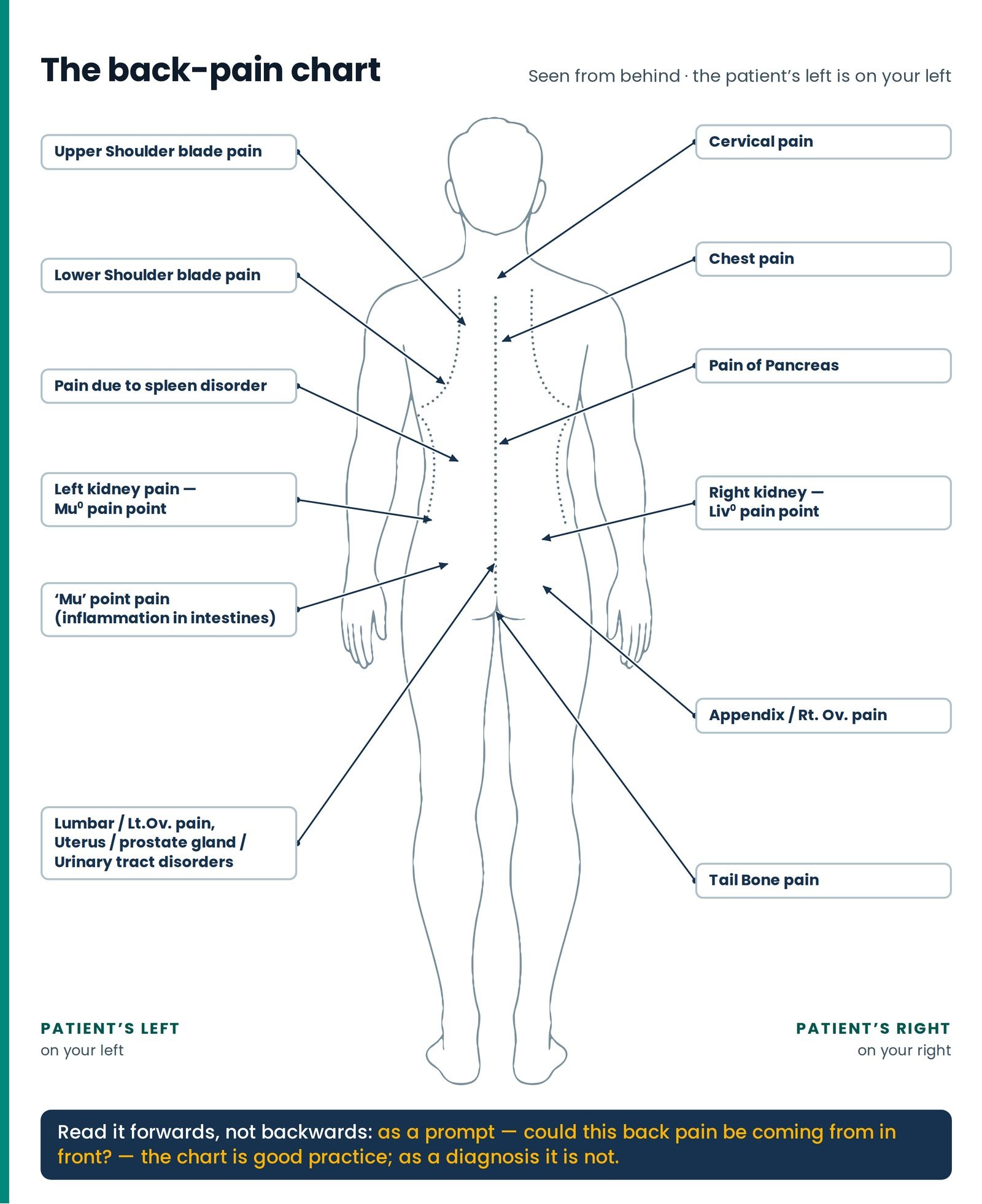 The back-pain chart. A whole-body outline seen from behind, with the spine, shoulder blades and flank curves dotted and