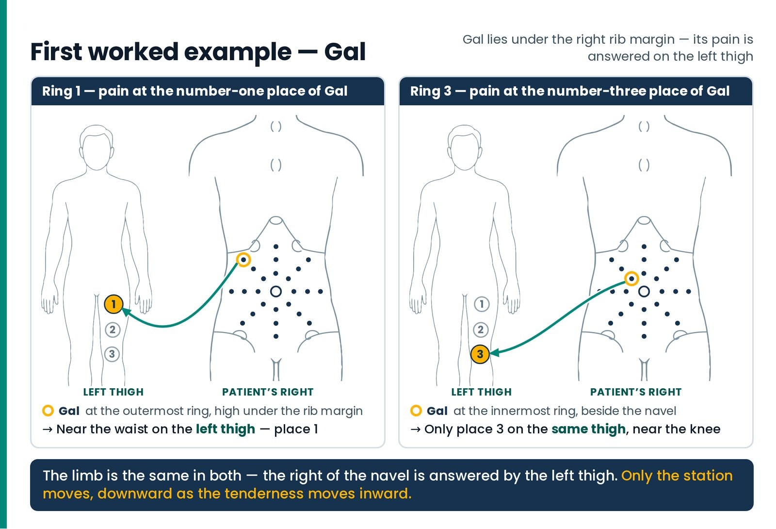 First worked example — Gal. Two paired scenes. Gal pain at ring 1, high under the right rib margin, is answered near the