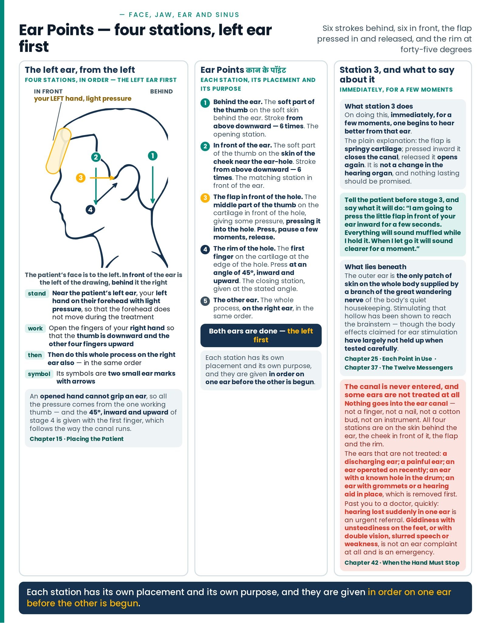 Ear Points — four stations, left ear first. The patient's left ear seen from the left, with the steadying hand on the fo