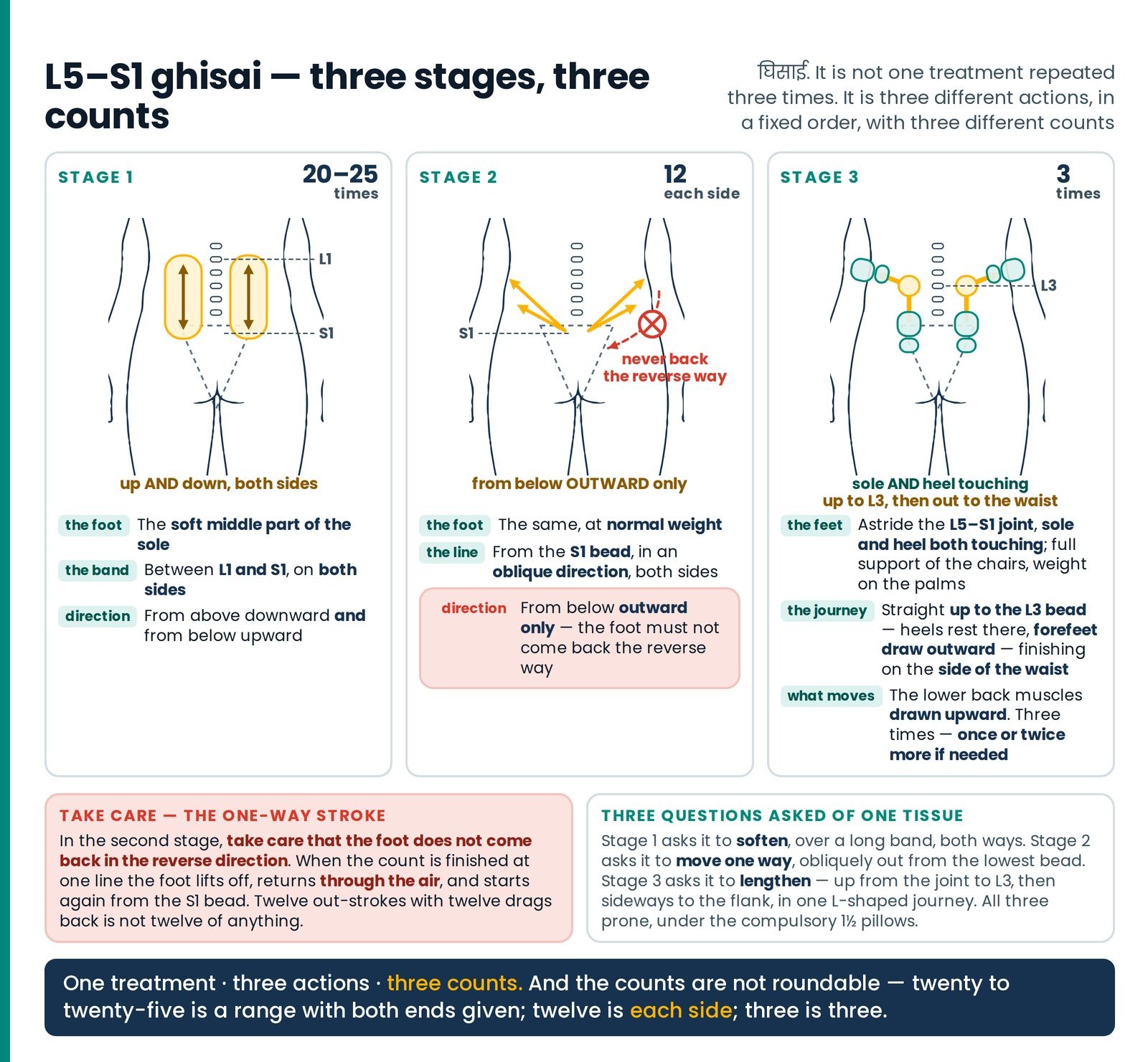L5–S1 ghisai — three stages, three counts. The article's opening treatment drawn as three separate actions on the same p