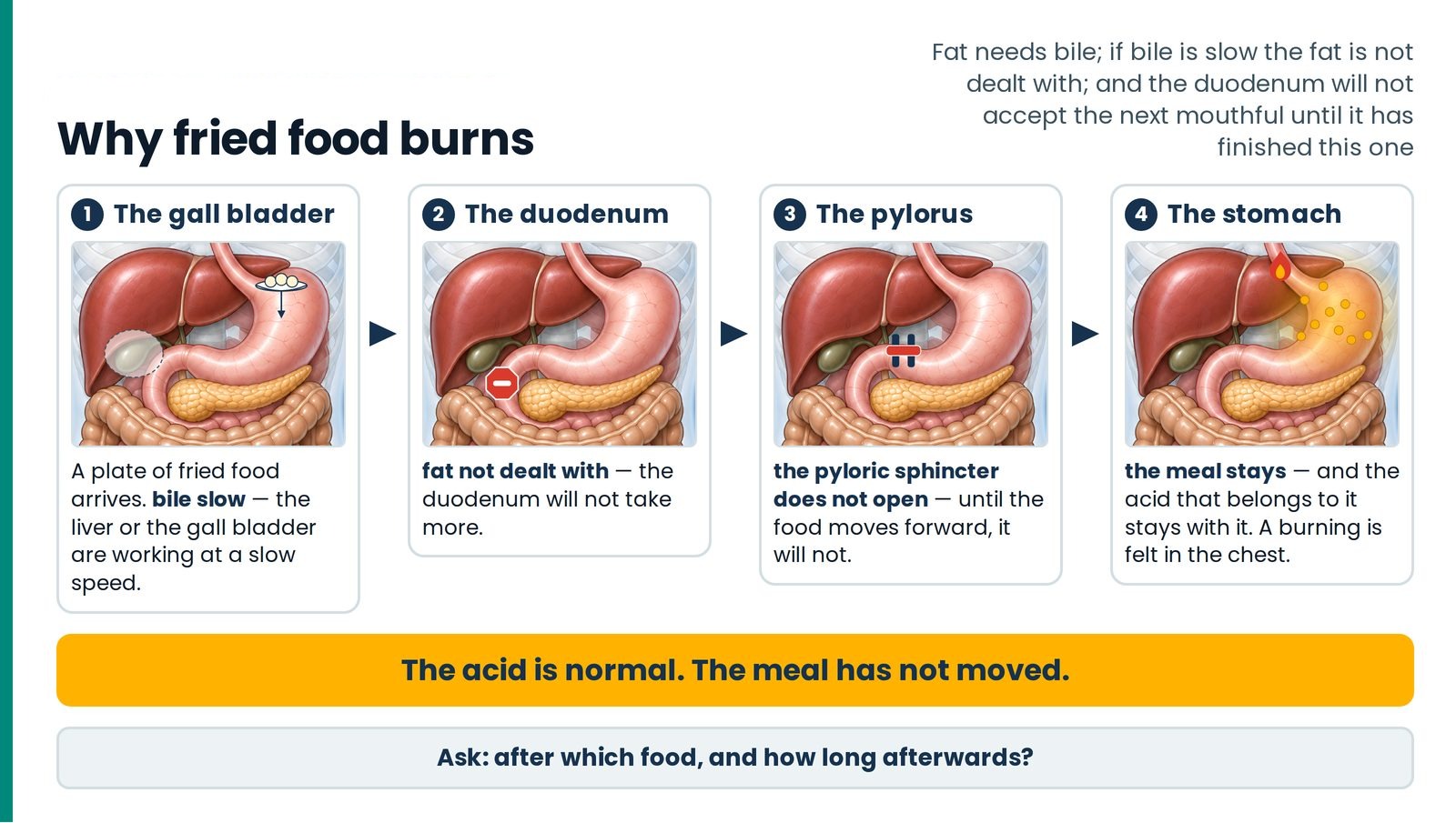 Why fried food burns. The chain of the Chole section in four panels — a slow gall bladder, fat not dealt with, a pyloric